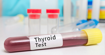 Blood Tests: Thyroid Stimulating Hormone (TSH) | Thyroid 