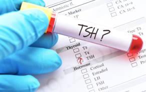 New Thyroid Dysfunction Screening Guideline